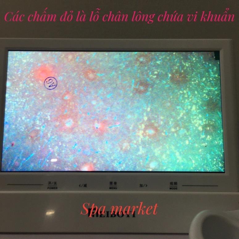 Giá cả của máy soi da mini tại Việt Nam là bao nhiêu và nơi mua máy soi da mini uy tín là gì?