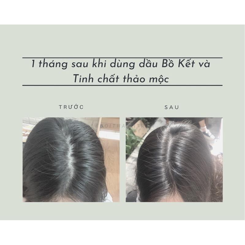 Ai nên dùng dầu gội đầu bồ kết?