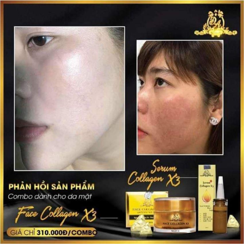 Liệu có cần kết hợp sử dụng bất kỳ sản phẩm nào khác không khi sử dụng combo serum và bộ kem colagen?